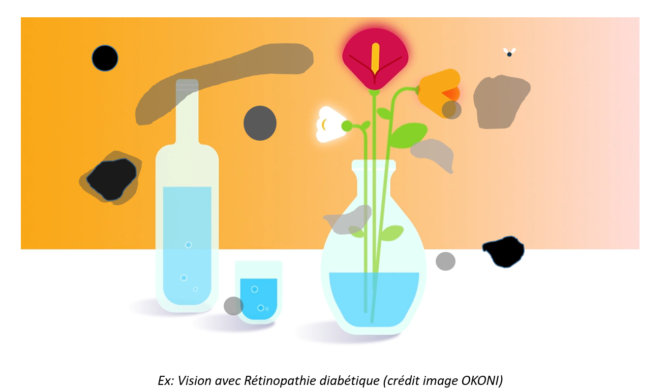 taches noires diss&eacute;min&eacute;es dans l'image