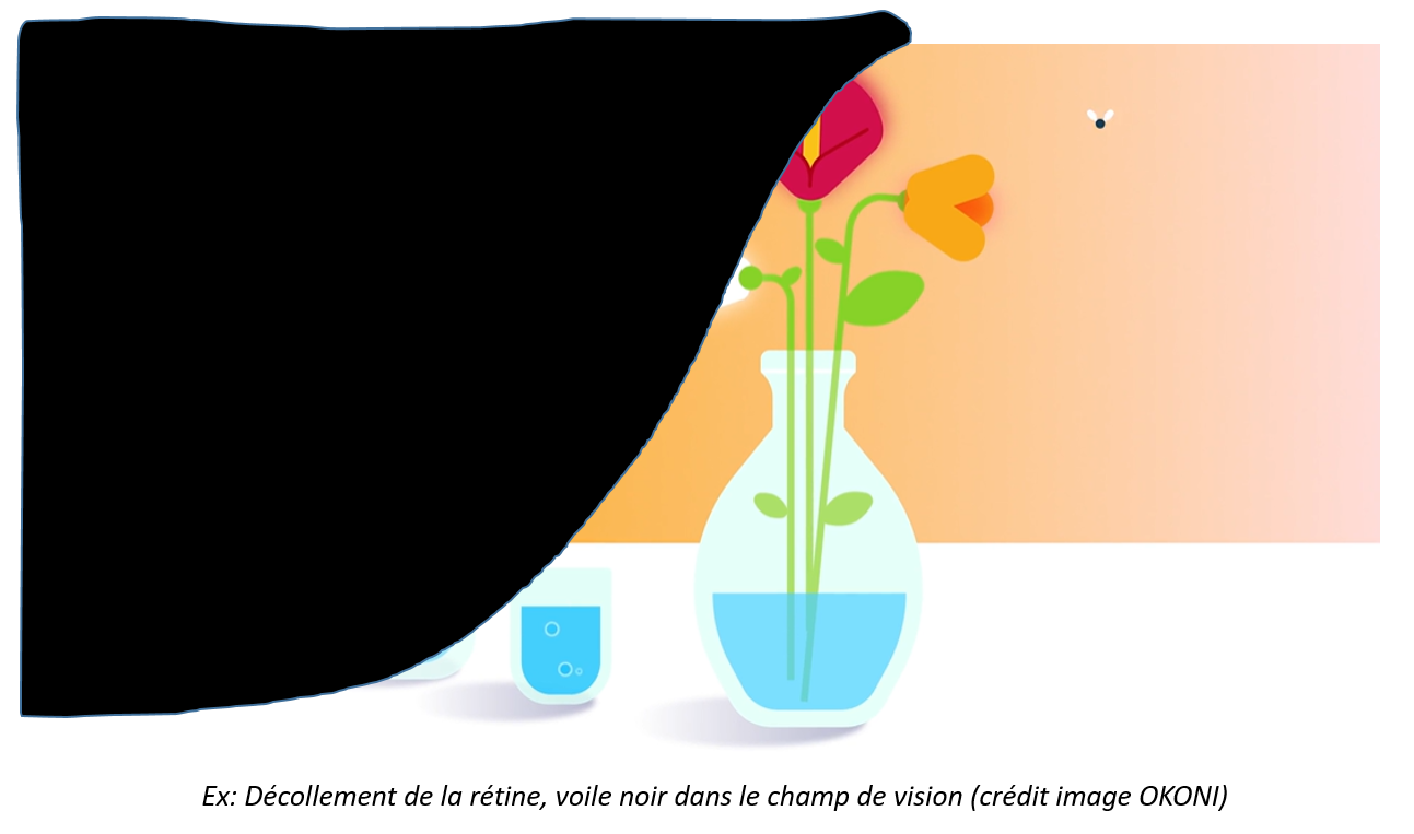 moitié de l'image avec voile noir